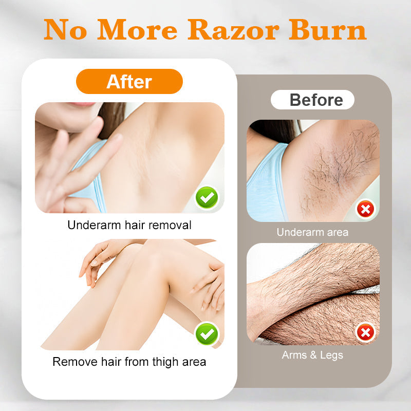 🏆 Last Day Special Price £9.78 ! 🔥Buy 2 Get 1 Free🔥100ml No Irritation Hair Removal Spray