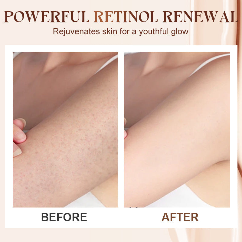 Retinol Firming & Repair Body Lotion